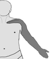 distribution pattern of anesthesia